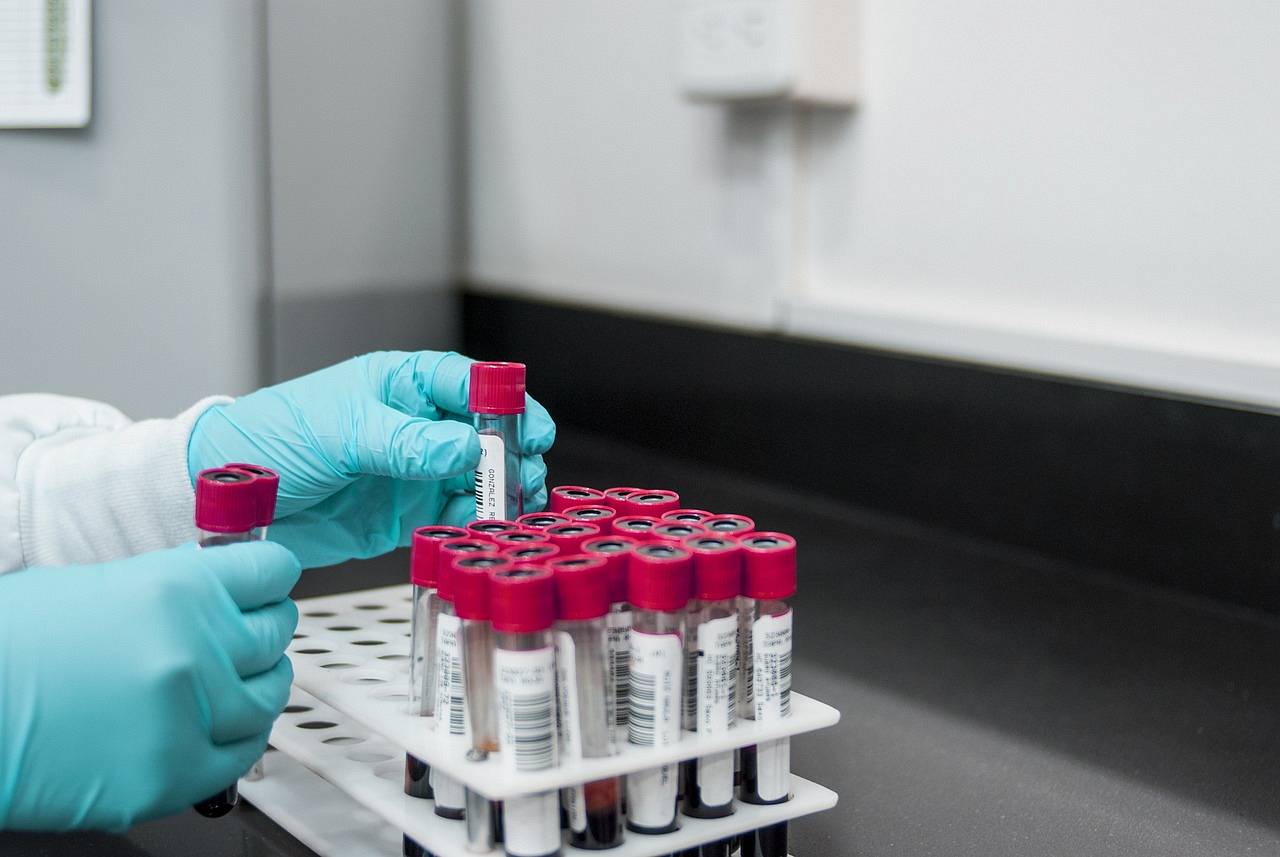 Blood samples are waiting to be tested by specialists